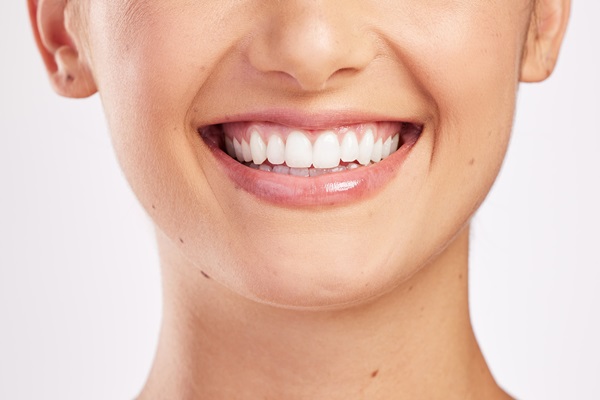 Take Home Professional Teeth Whitening Options From Your General Dentist